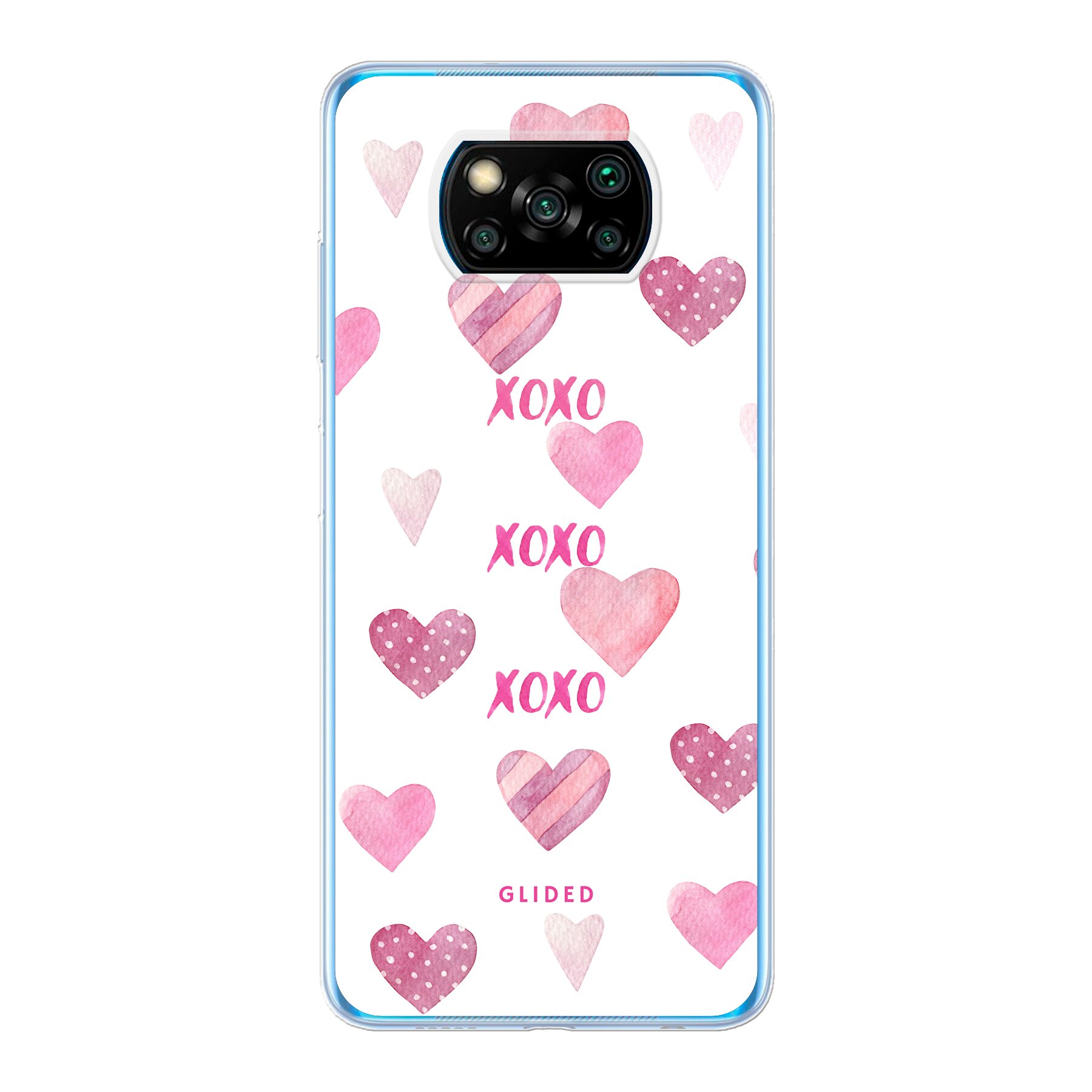 Produktbild Xoxo - Xiaomi Poco X3 NFC Handyhülle
