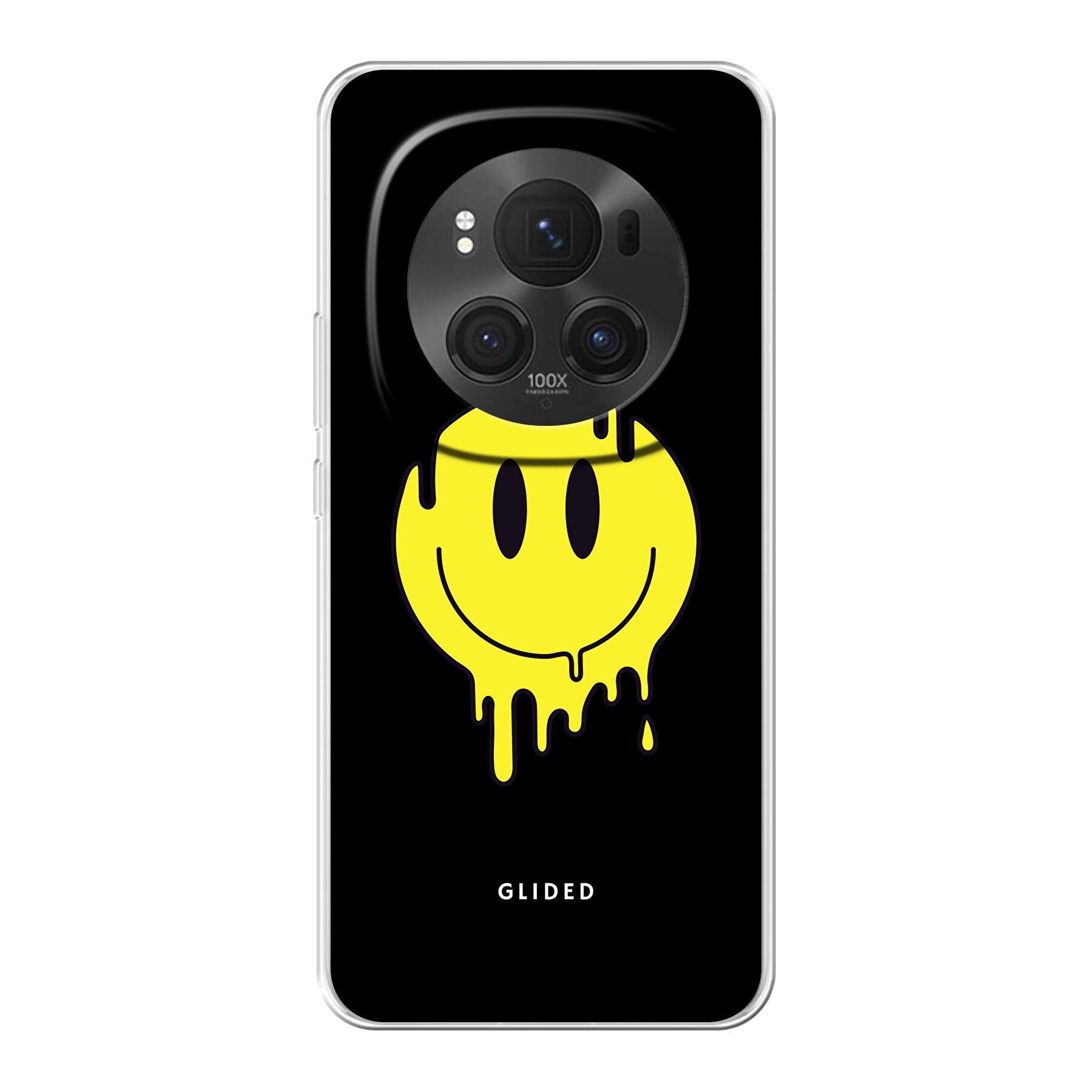 Product image Too hot - Honor Magic6 Pro Phone case